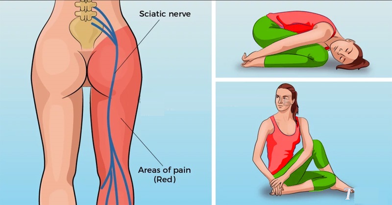 8 Yoga Poses For Sciatica Pain