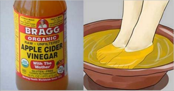 If You Soak Your Feet In Apple Cider Vinegar, This Is What Happens… That’s Amazing!
