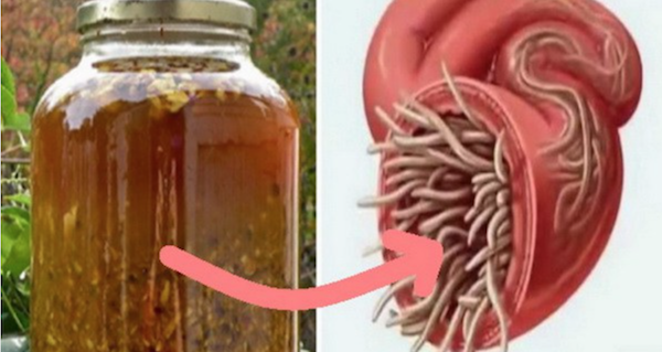 The Most Powerful Natural Antibiotic Ever, It Cures Any Infection In The Body And Kills Parasites!