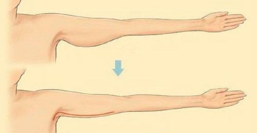 THE MOST EFFECTIVE EXERCISES TO GET RID OF SAGGY ARM SKIN
