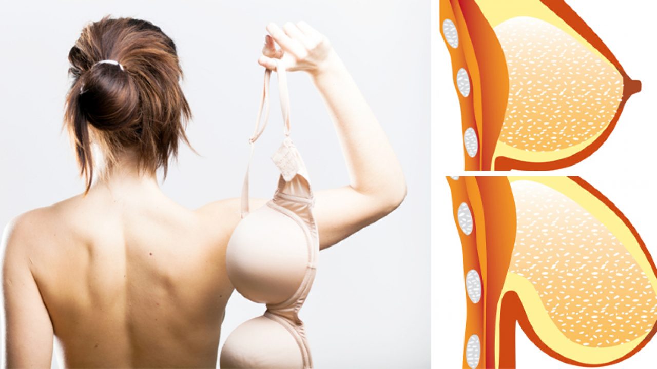 Scientists tell women to stop wearing bras. The reason? Amazing!