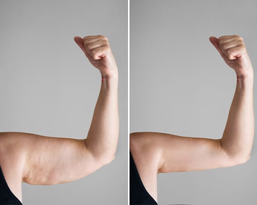 3 arm and shoulder workout you can do at home in just 3 minutes