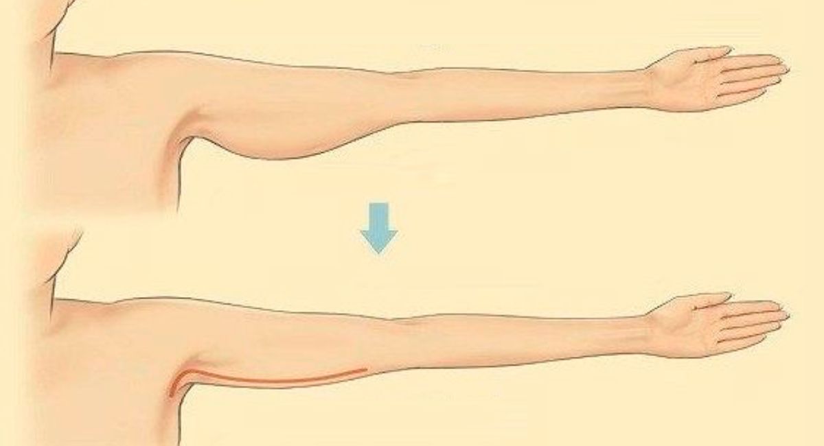 THE MOST EFFECTIVE EXERCISES TO GET RID OF SAGGY ARM SKIN - Gardeniaworld